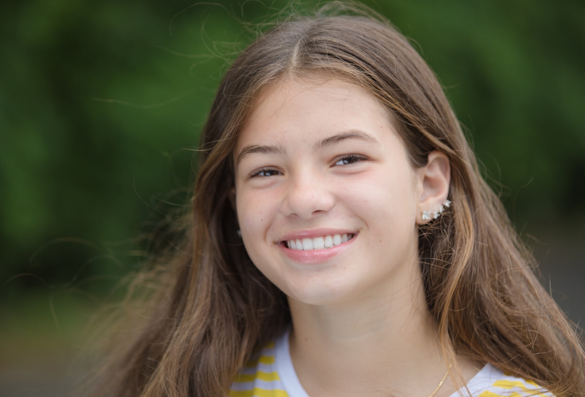 teen boy wearing invisalign clear aligners