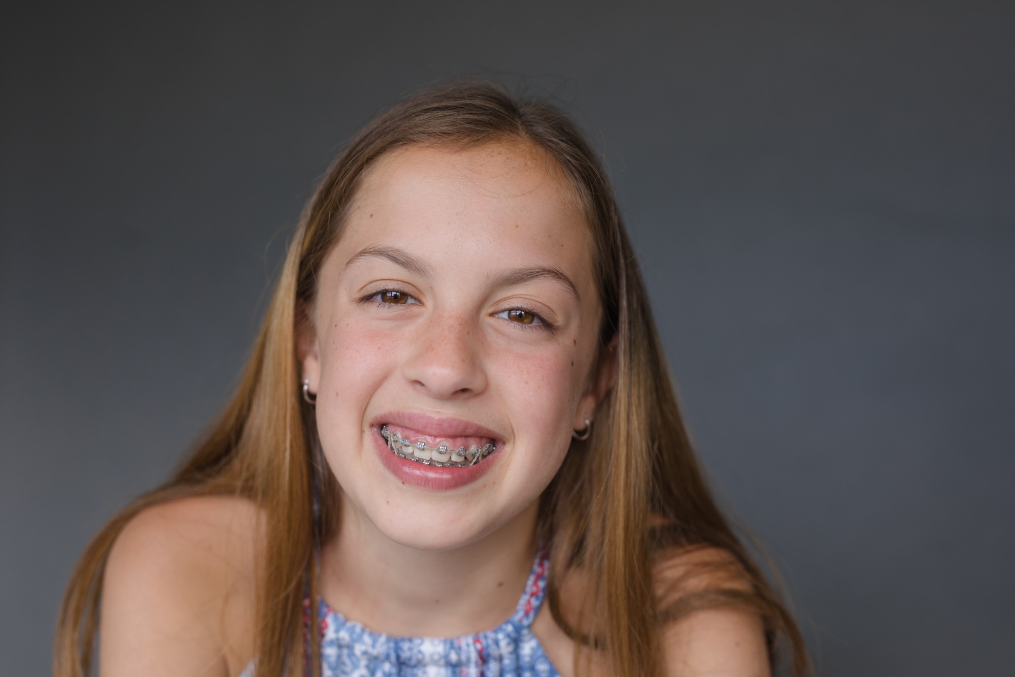 Metal Braces Nutley NJ Braces Clifton Orthodontist Passaic Braces