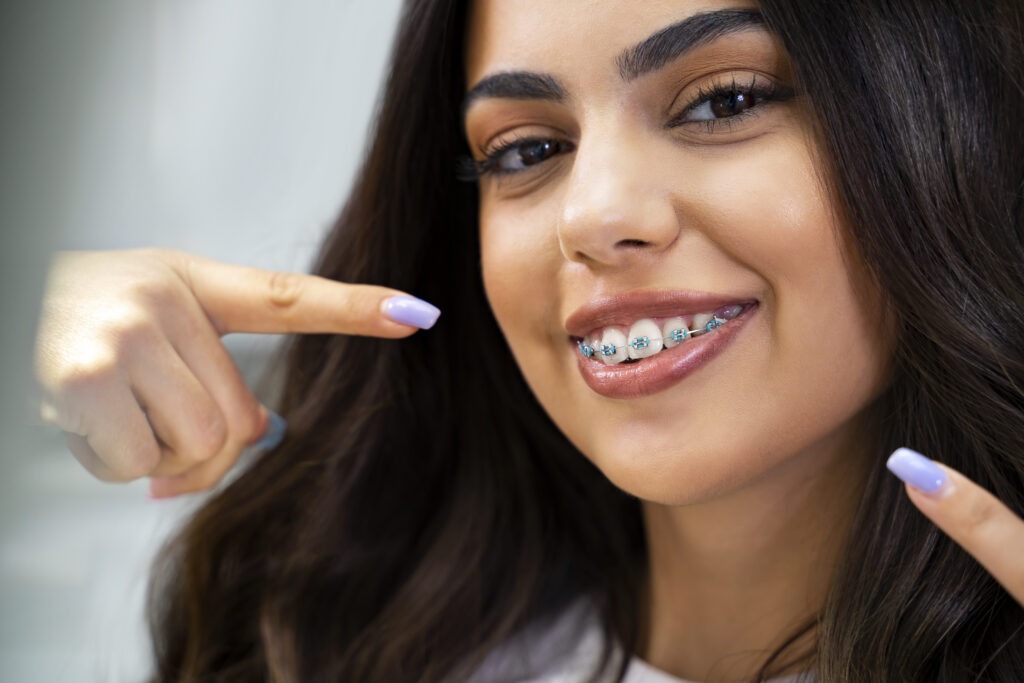 How Do Braces Work?