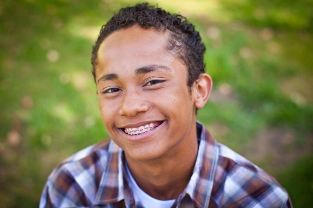 How To Look After Your Braces In Between Appointments