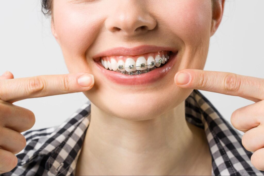 All About Affordable Orthodontic In Nutley