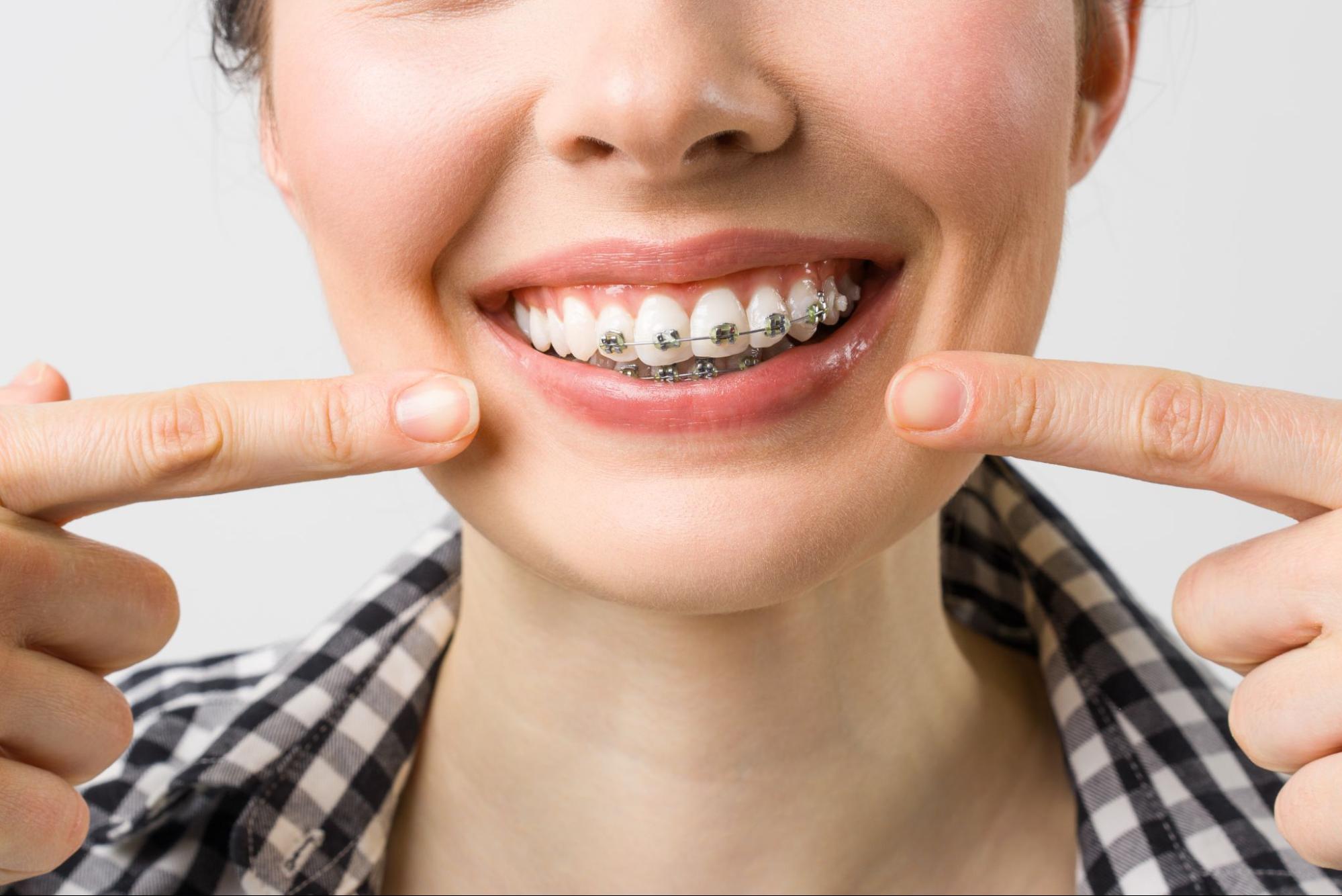 All About Affordable Orthodontic In Nutley